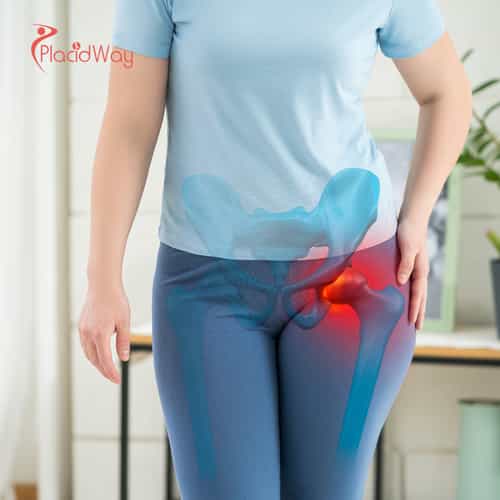 Hip Regeneration Stem Cell Therapy in Thailand: The Complete Guide